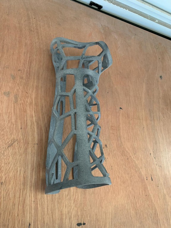 גבס ילדים בהדפסת 3D - פרויקט Indus3D
