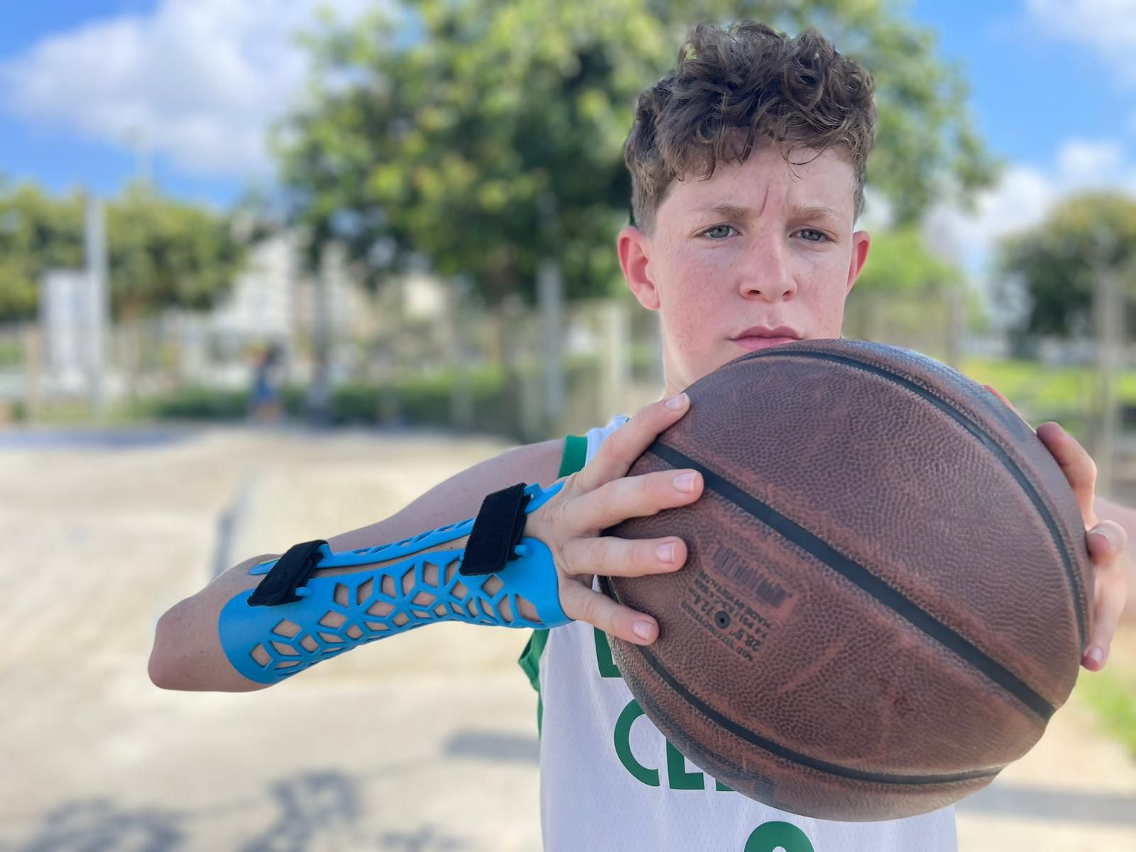 גבס ילדים מודפס בתלת מימד עם Gero3D - פרויקט של Indus3D